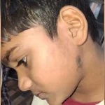 हरदोई में सहायक अध्यापक ने छात्र की पिटाई की, नाक से खून बहने व चेहरे पर उंगलियों के निशान के बाद परिजनों ने थाने पर दी तहरीर
