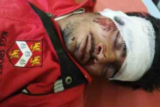 Hardoi News: नशे की हालत मे बाईक से गिरा युवक, घायल रेफर, कोथावा अतरौली मार्ग पर मीनाबाजार समीप का मामला